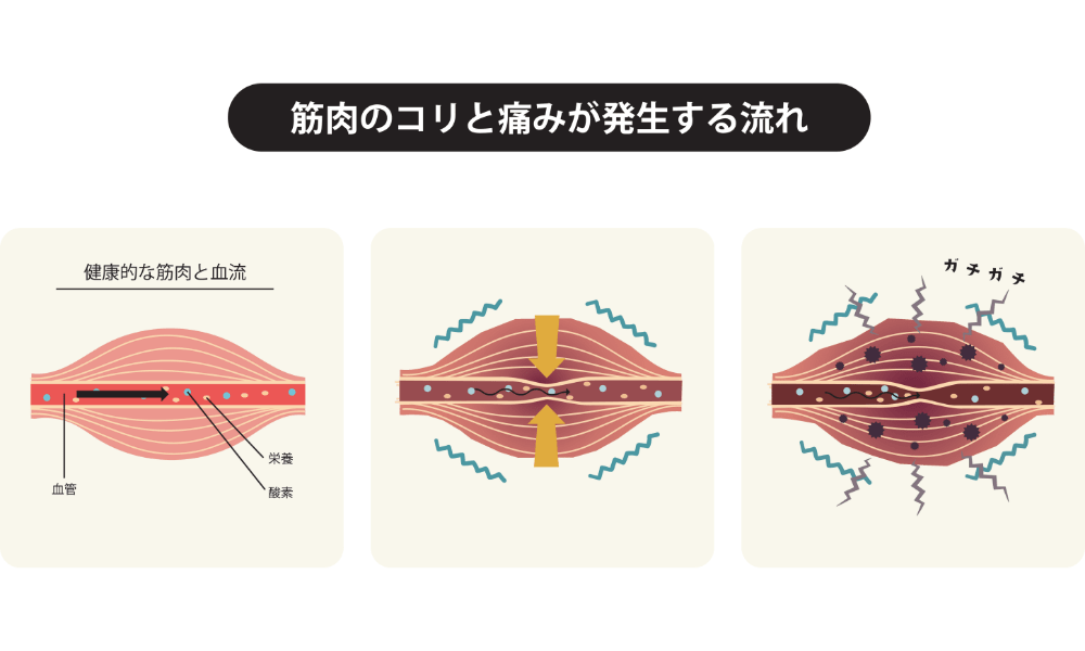 血流とコリ・痛みの関係
